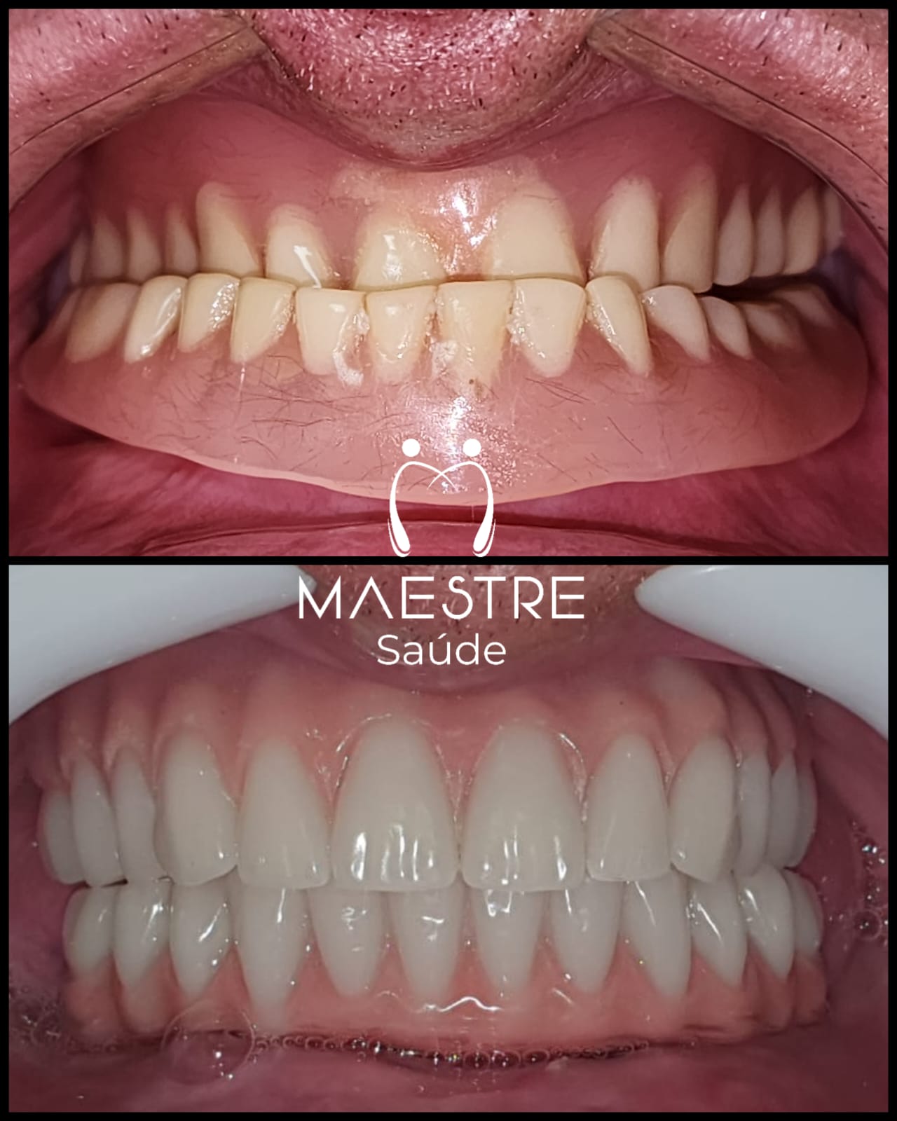 antes e depois João Batista