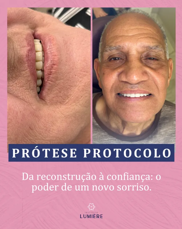 caso 1