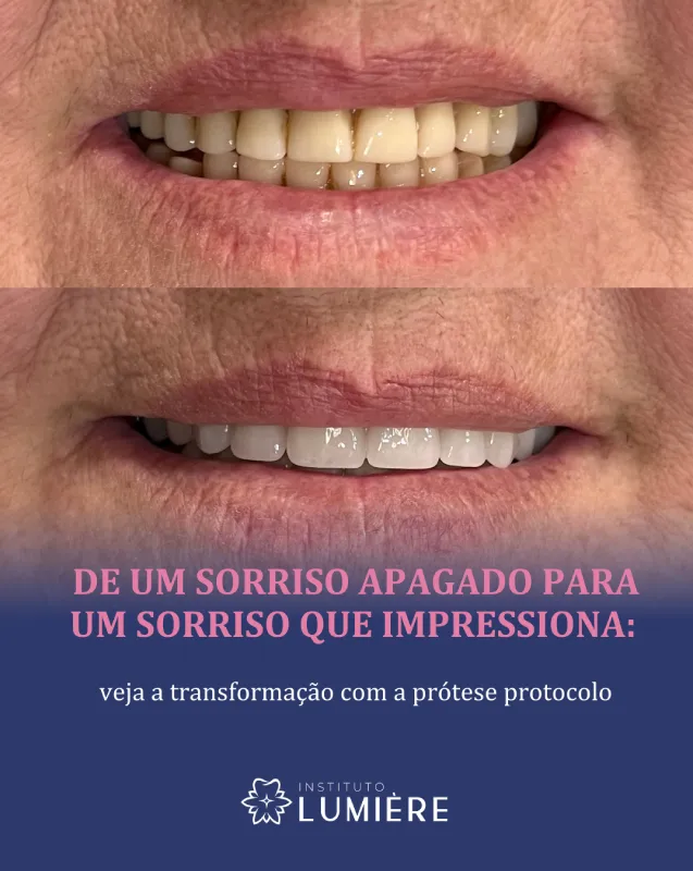 caso 2